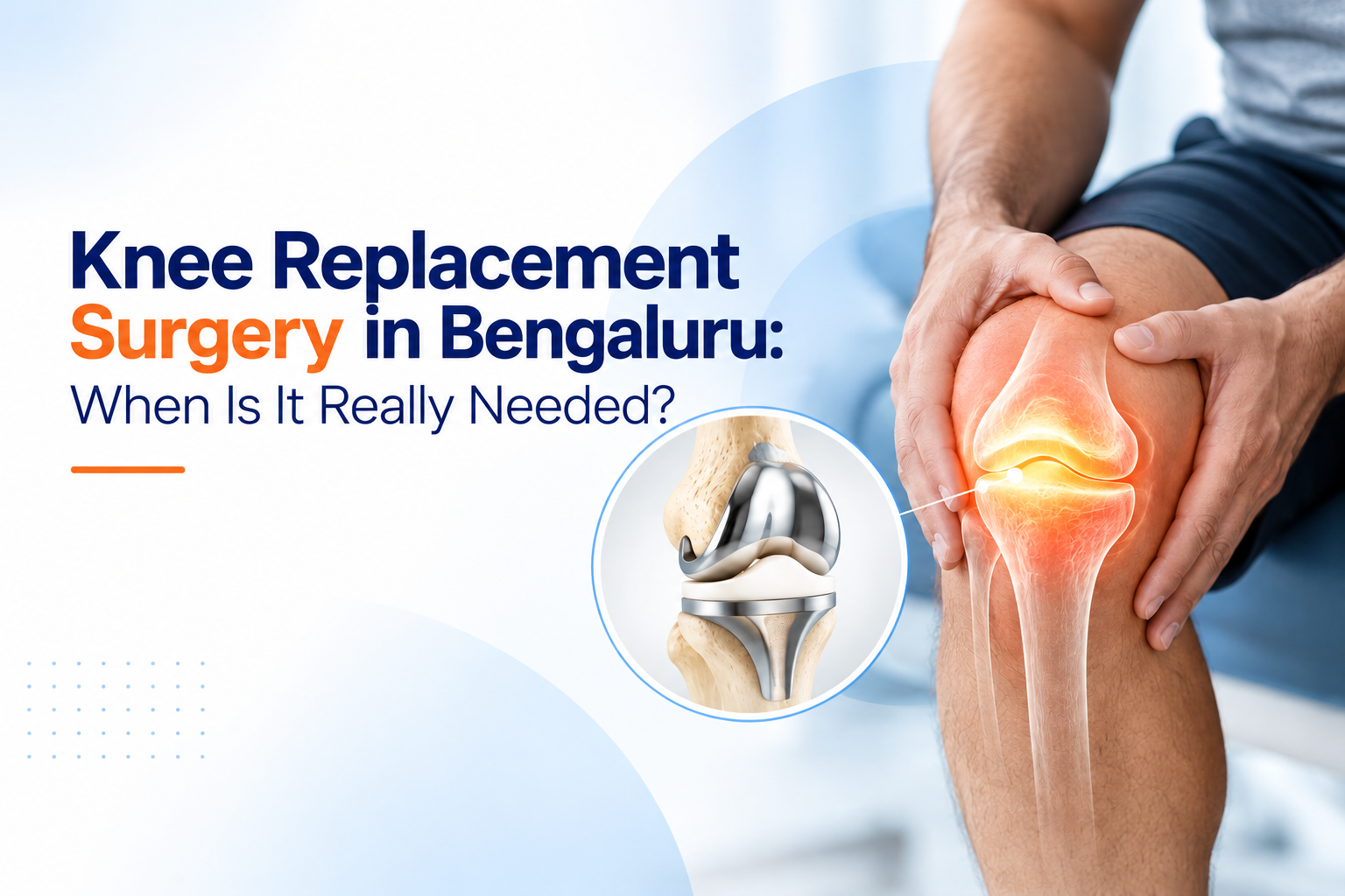 Knee Replacement Surgery in Bengaluru: When Is It Really Needed?